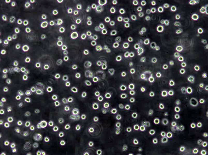 Mac-1 Lymphoblast Cell|人皮肤T淋巴瘤传代细胞(有STR鉴定)
