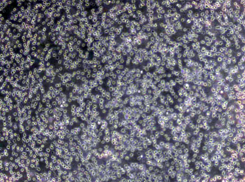 SU-DHL-5 Lymphoblast Cell|人弥漫大D传代细胞(有STR鉴定)