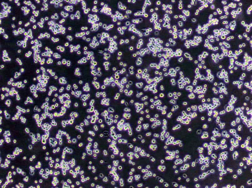 MT-3 [Human leukocytes] Lymphoblast Cell|人脐血白传代细胞(有STR鉴定)