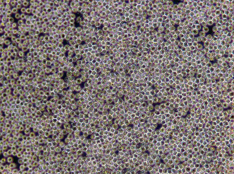 SU-DHL-16 Lymphoblast Cell|人B淋巴瘤传代细胞(有STR鉴定)