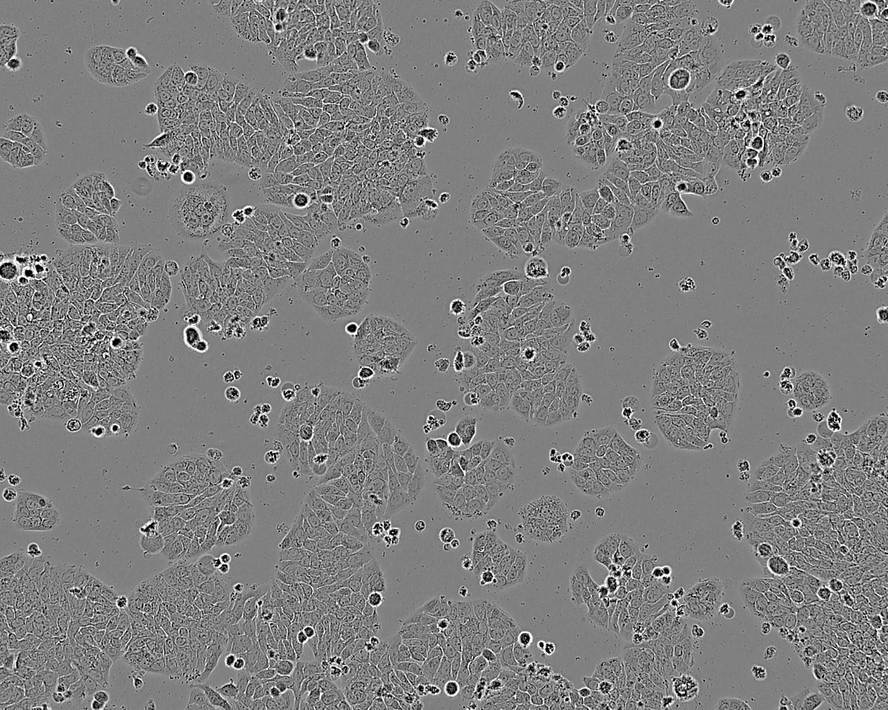 SCLC-21H Epithelial Cell|人小细胞肺癌传代细胞(有STR鉴定)