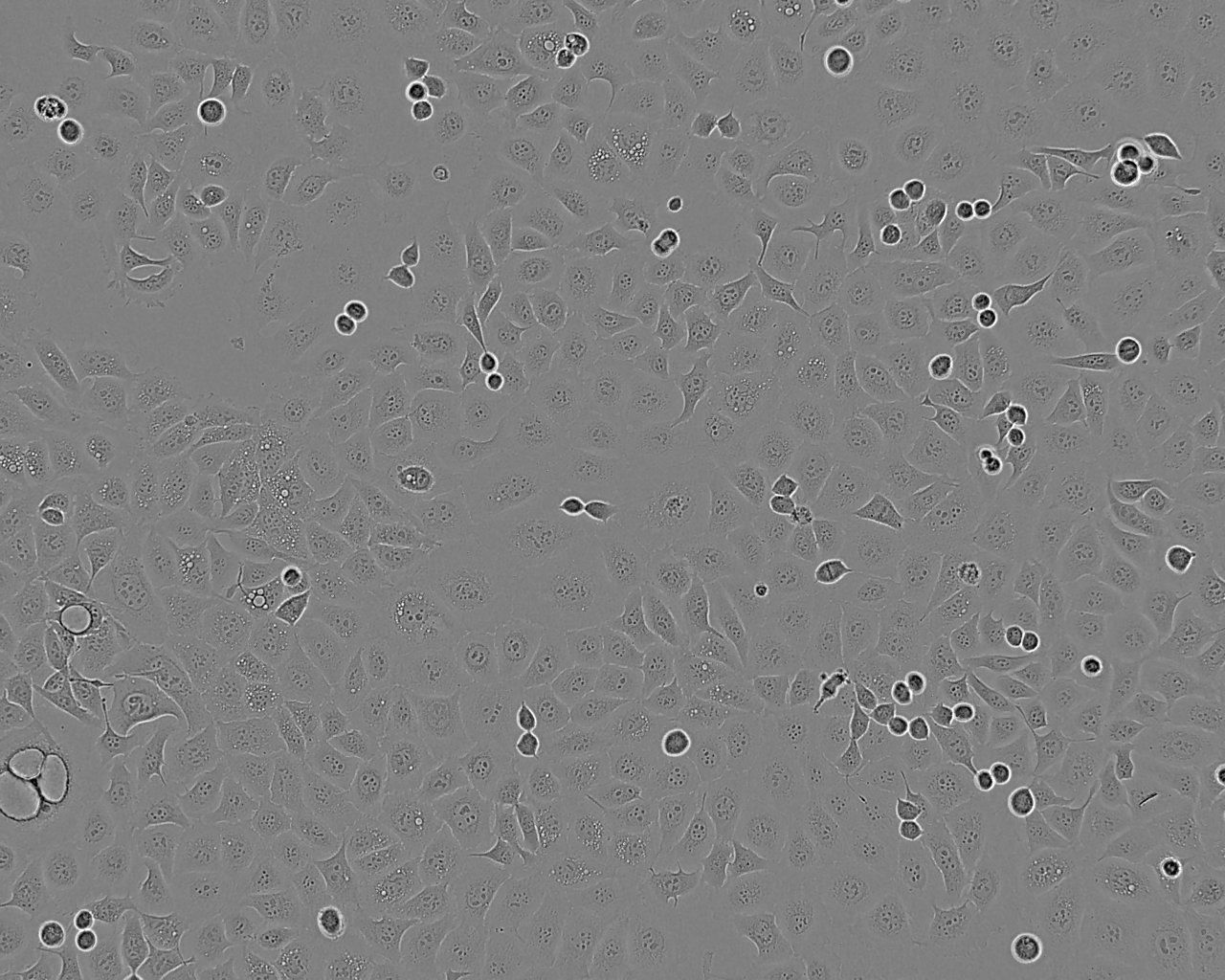 KYSE-140 Epithelial Cell|人食管鳞癌传代细胞(有STR鉴定)