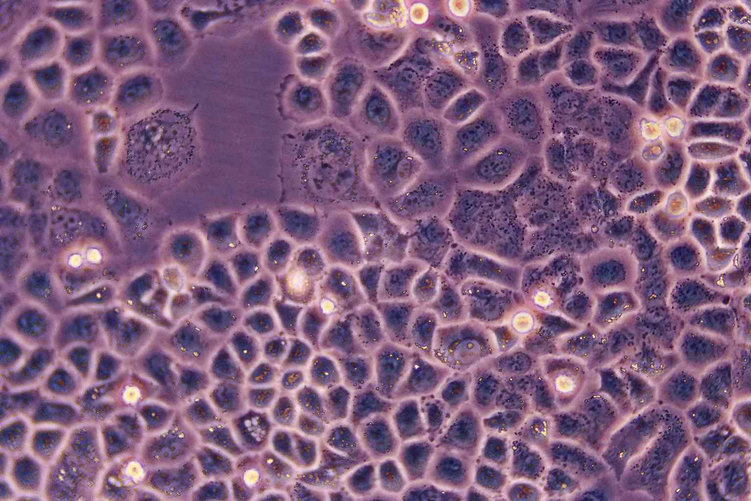 IMR-32 Epithelial Cell|人神经母细胞瘤传代细胞(有STR鉴定)