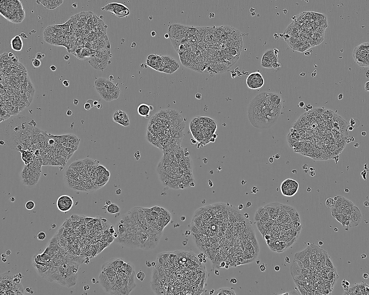 A-875 Epithelial Cell|人黑色素瘤传代细胞(有STR鉴定)