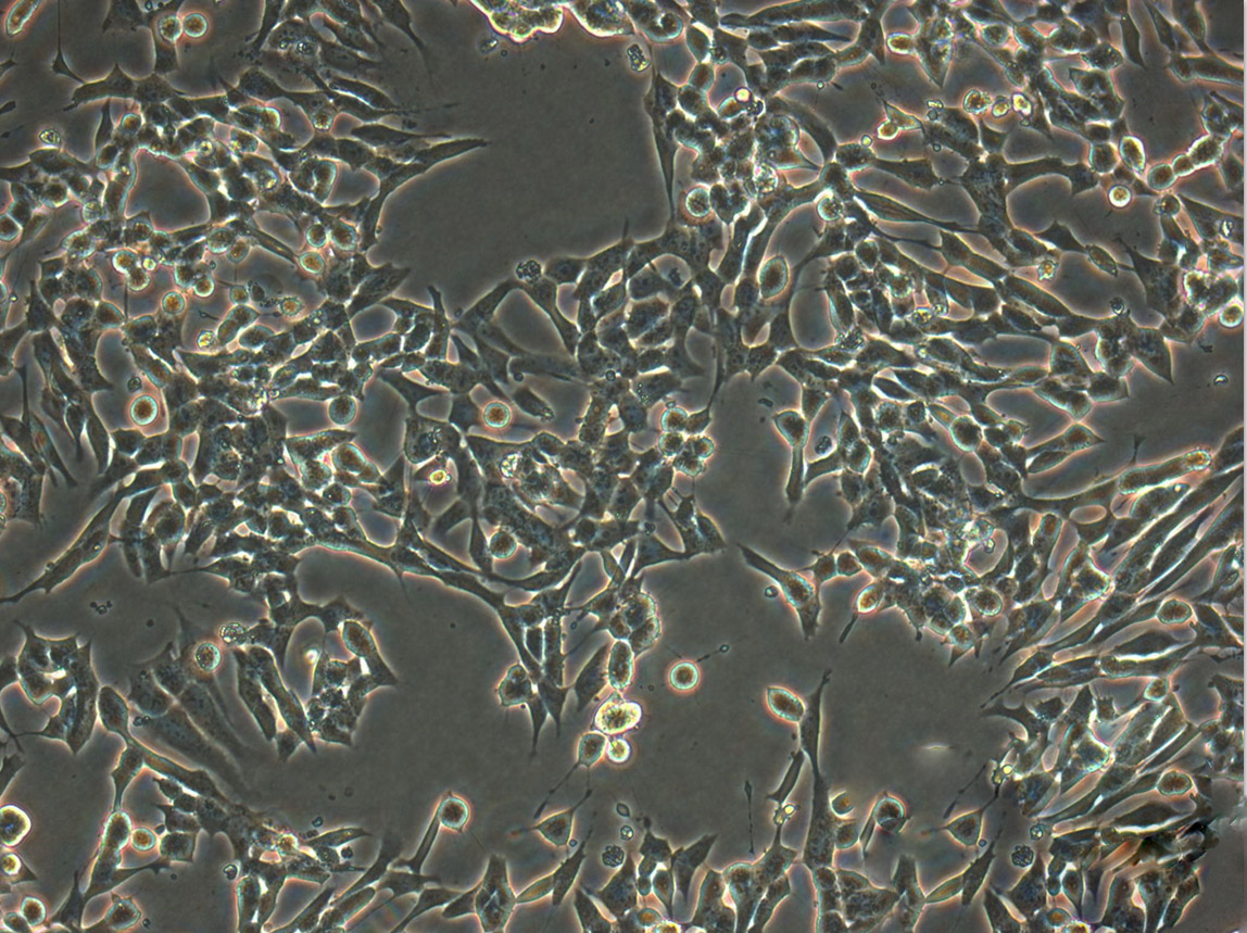 MDA-MB-415 Epithelial Cell|人乳腺腺癌传代细胞(有STR鉴定)