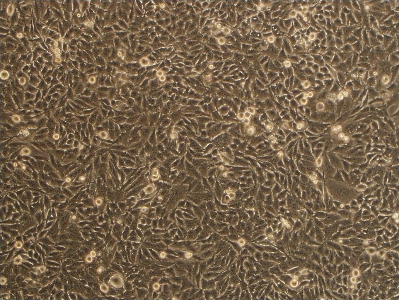 MDA-MB-468 Epithelial Cell|人乳腺癌传代细胞(有STR鉴定)