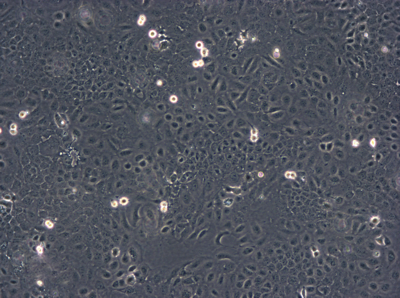 HBL-100 Epithelial Cell|人整合SV40基因的乳腺上皮传代细胞(有STR鉴定)