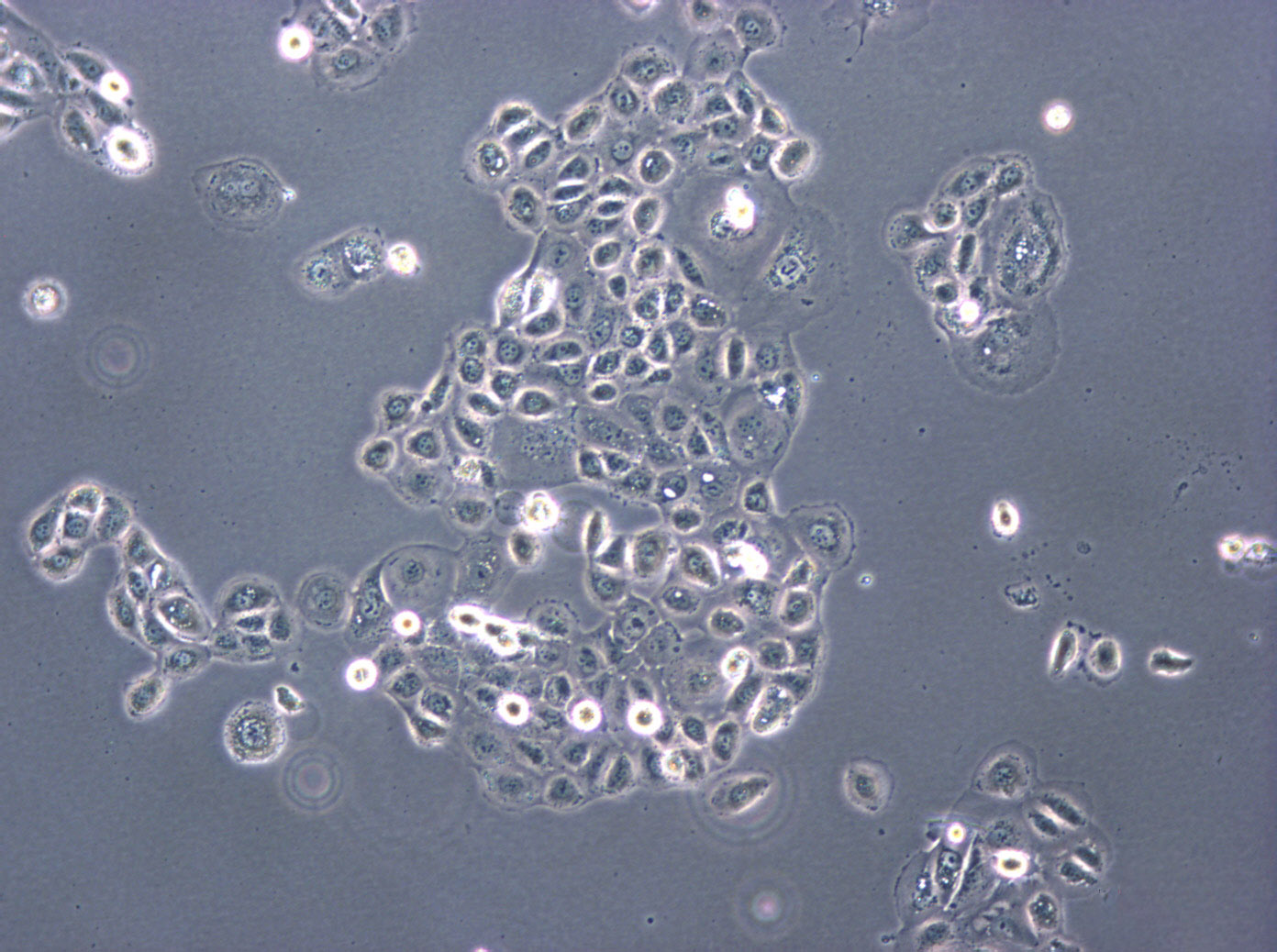 BeWo Epithelial Cell|人胎盘绒膜癌传代细胞(有STR鉴定)