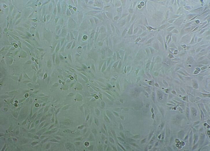 NCI-H1395 Epithelial Cell|人非小细胞肺癌传代细胞(有STR鉴定)