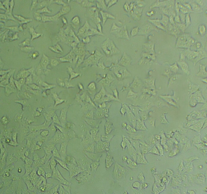 NCI-H1355 Epithelial Cell|人非小细胞肺癌传代细胞(有STR鉴定)