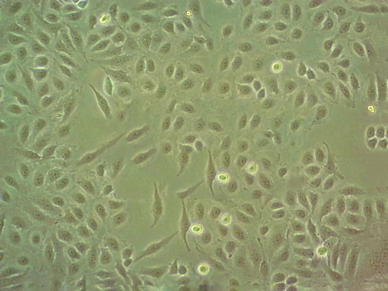 NCI-H1792 Epithelial Cell|人肺癌腺癌传代细胞(有STR鉴定)