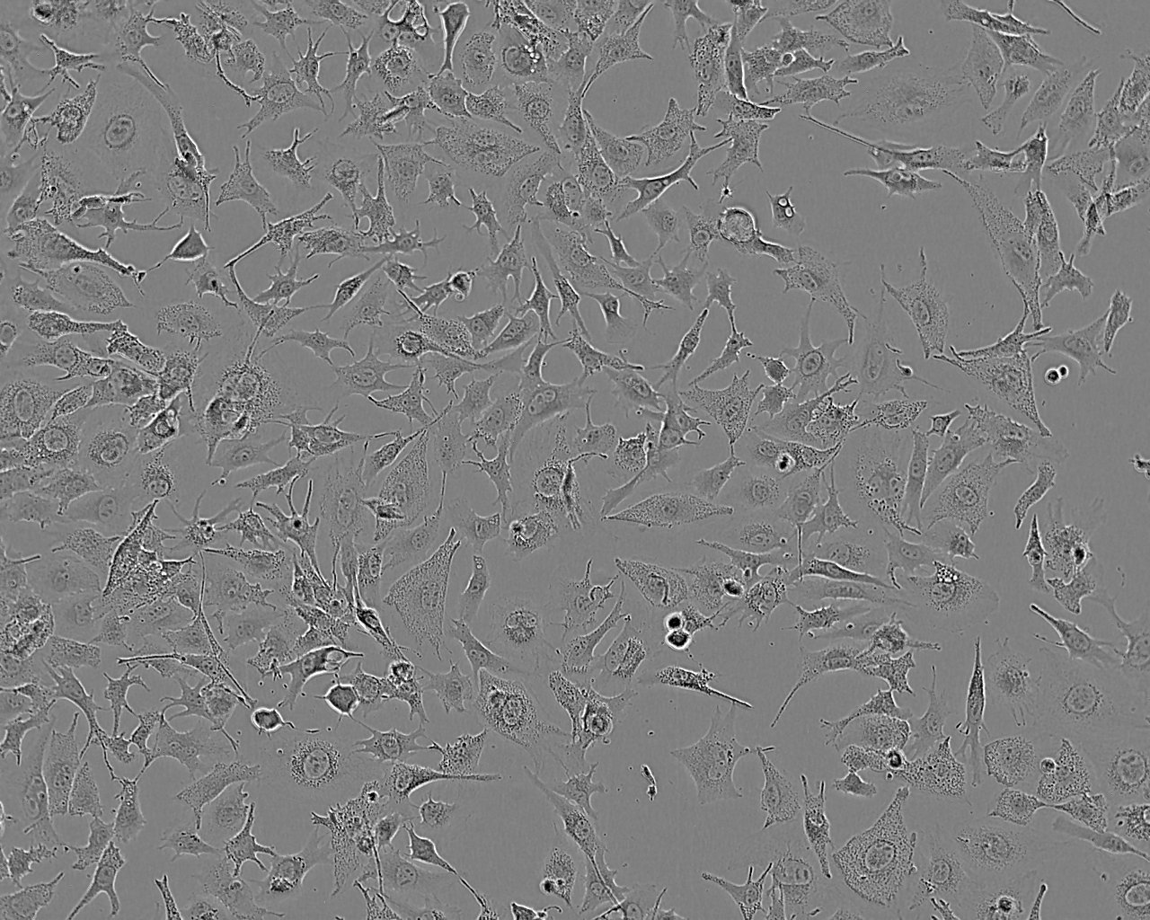 NCI-H2228 Epithelial Cell|人非小细胞肺癌传代细胞(有STR鉴定)