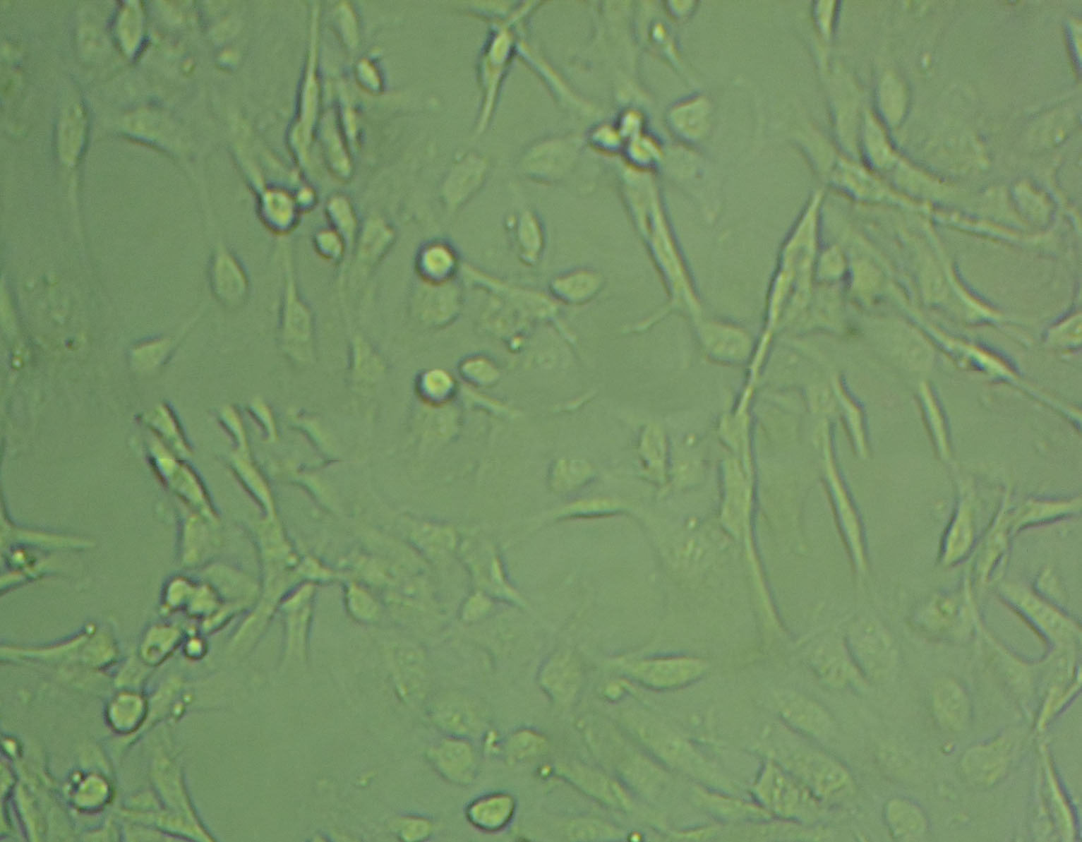 NCI-H1581 Epithelial Cell|人非小细胞肺癌传代细胞(有STR鉴定)