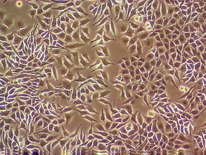 NCI-H1623 Epithelial Cell|人非小细胞肺癌传代细胞(有STR鉴定)