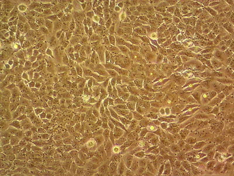 NCI-H2172 Epithelial Cell|人非小细胞肺癌传代细胞(有STR鉴定)