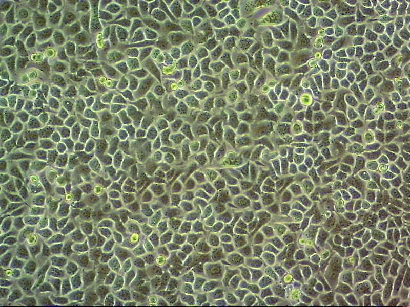 NCI-H647 Epithelial Cell|人非小细胞肺癌传代细胞(有STR鉴定)
