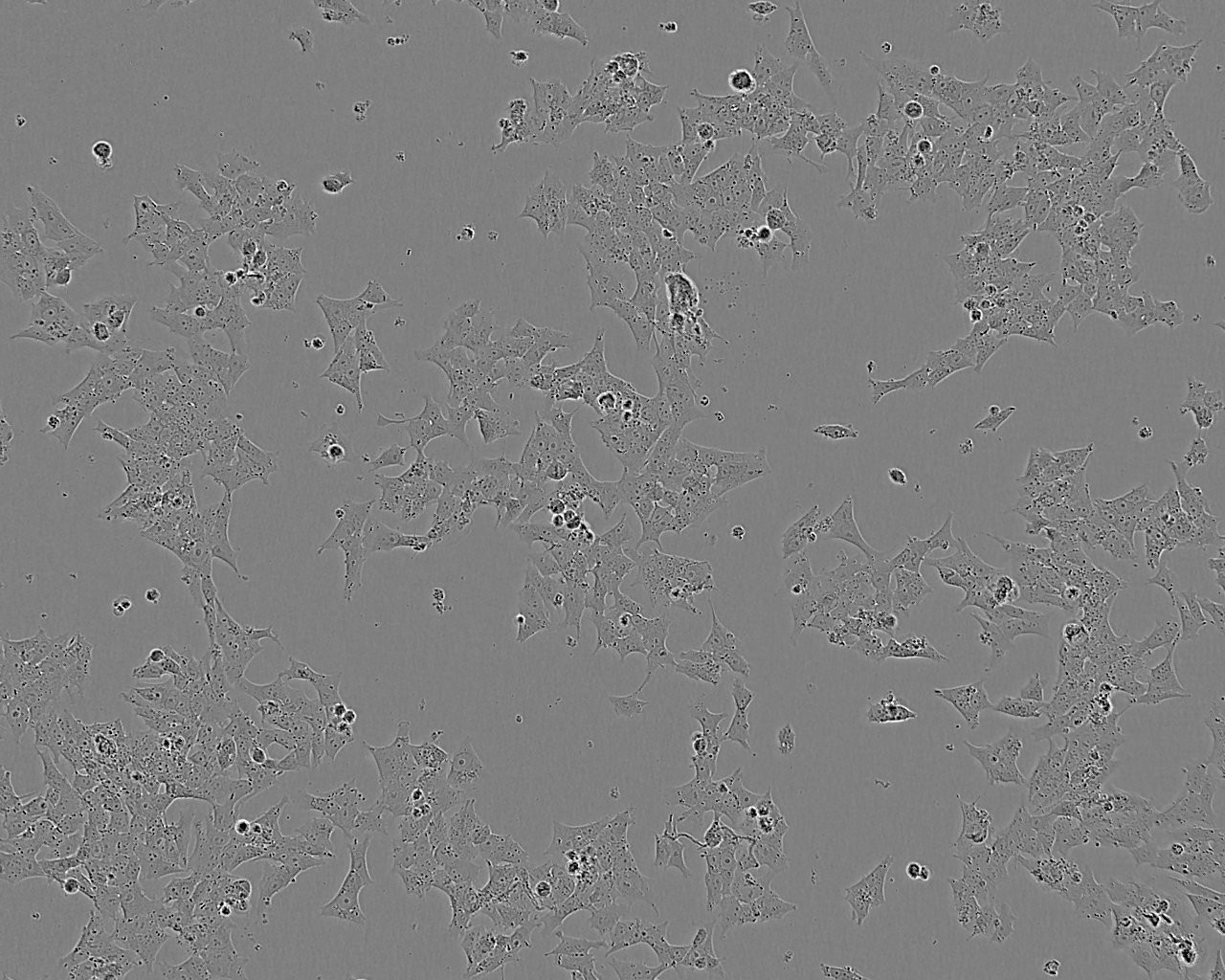 NCI-H1963 Epithelial Cell|人小细胞肺癌传代细胞(有STR鉴定)