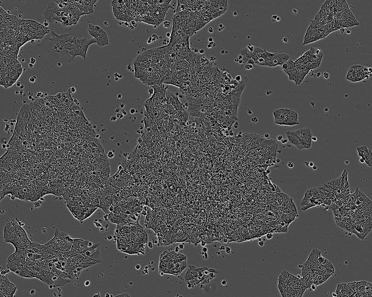 NCI-H1341 Epithelial Cell|人小细胞肺癌传代细胞(有STR鉴定)