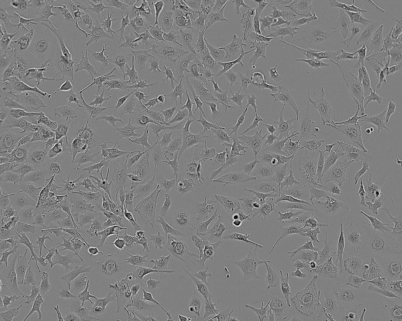 NCI-H196 Epithelial Cell|人肺癌传代细胞(有STR鉴定)