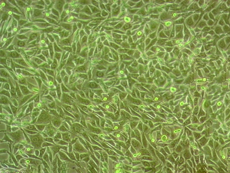 NCI-H82 Epithelial Cell|人小细胞肺癌传代细胞(有STR鉴定)