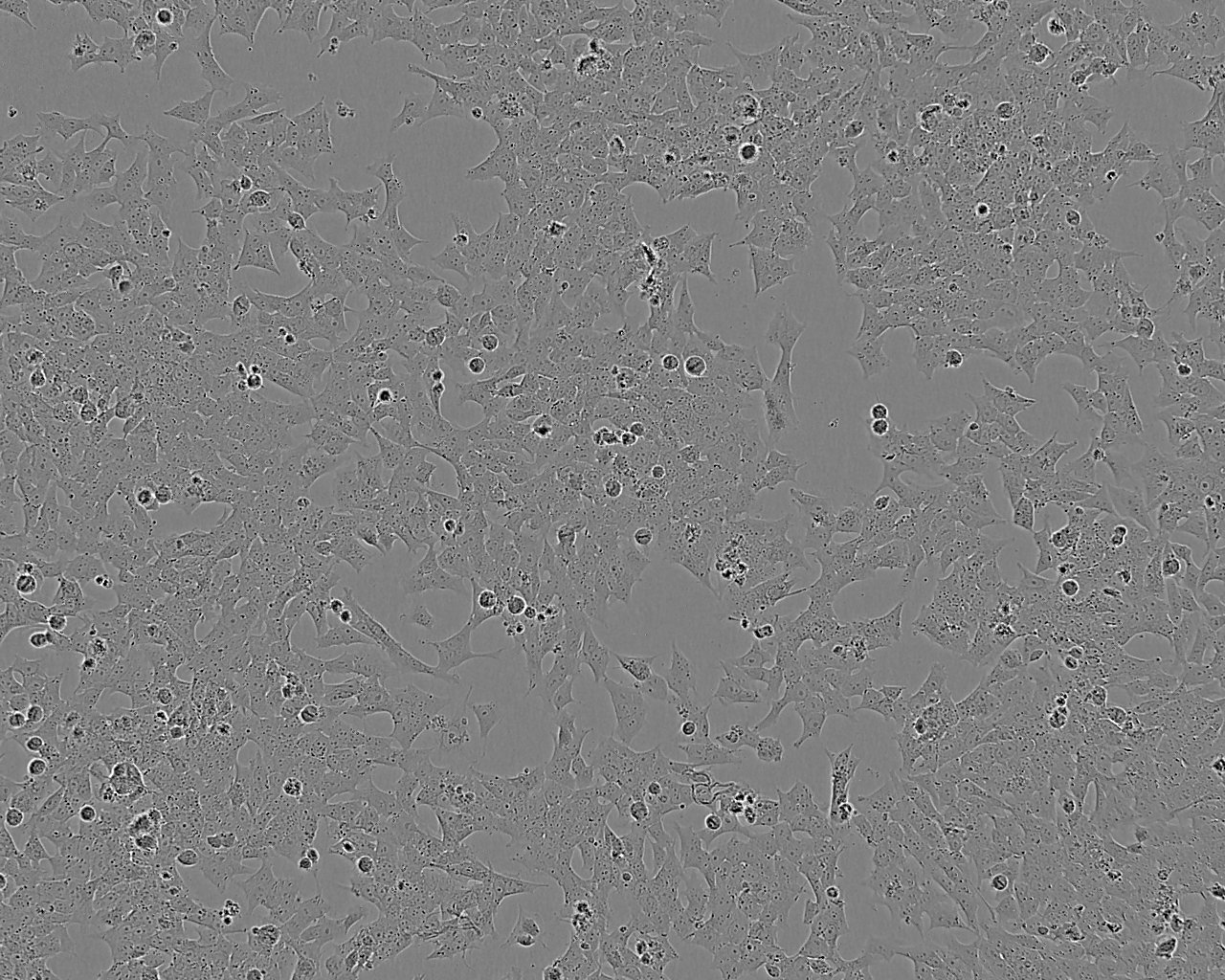 NCI-H889 Epithelial Cell|人肺癌传代细胞(有STR鉴定)