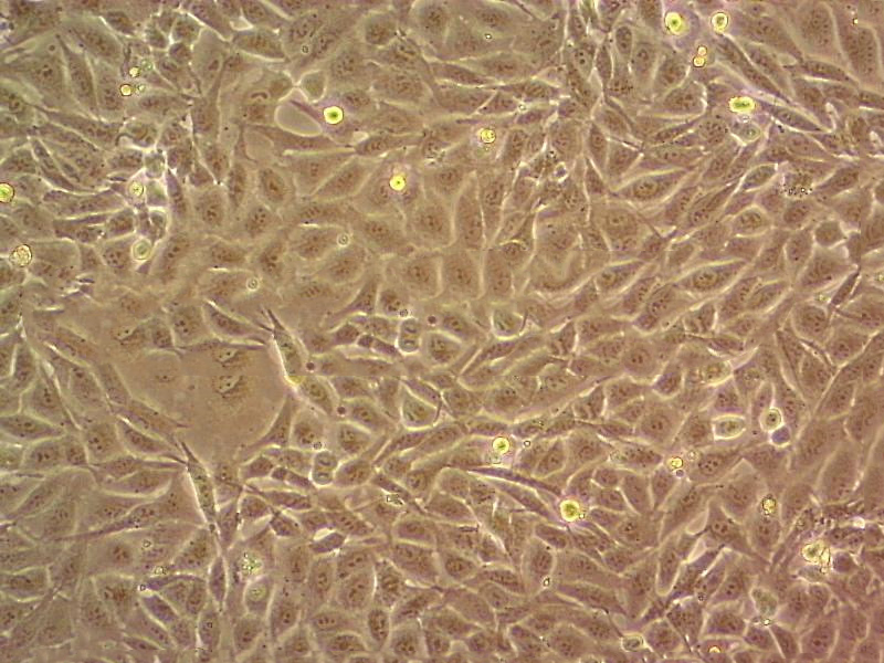 RD Epithelial Cell|人恶性胚胎横纹肌瘤传代细胞(有STR鉴定)