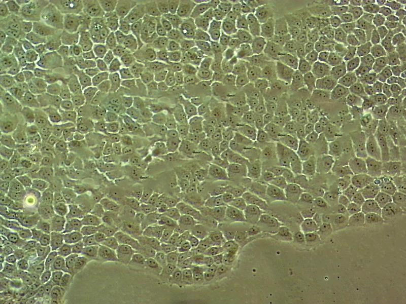 HSC-4 Epithelial Cell|人口腔鳞癌传代细胞(有STR鉴定)