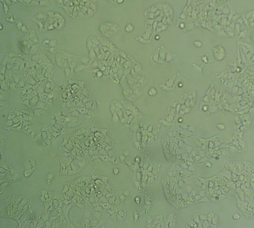 SCC-15 Epithelial Cell|人鳞状细胞癌传代细胞(有STR鉴定)