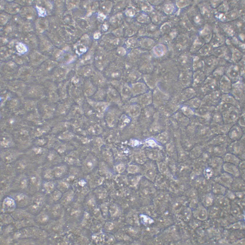 SCC-25 Epithelial Cell|人口腔鳞癌传代细胞(有STR鉴定)