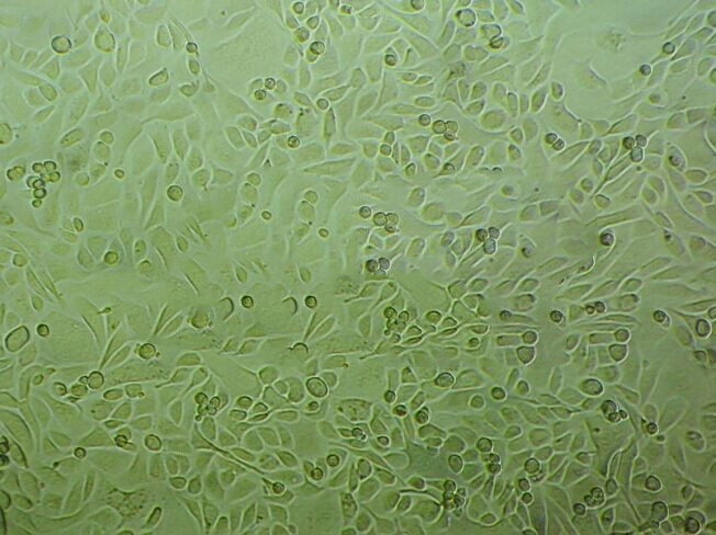 KMH-2 Epithelial Cell|人甲状腺癌传代细胞(有STR鉴定)