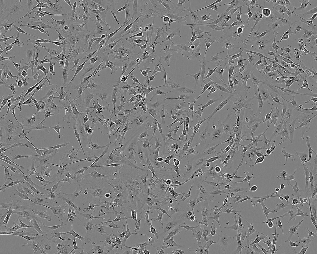 KYSE-410 Epithelial Cell|人食管鳞癌传代细胞(有STR鉴定)