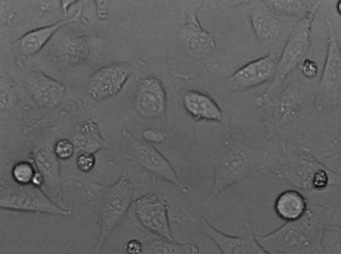 BT-474 Epithelial Cell|人乳腺导管瘤传代细胞(有STR鉴定)