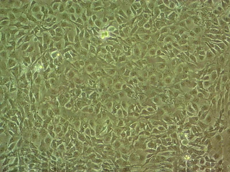 Anglne Epithelial Cell|人卵巢癌传代细胞(有STR鉴定)
