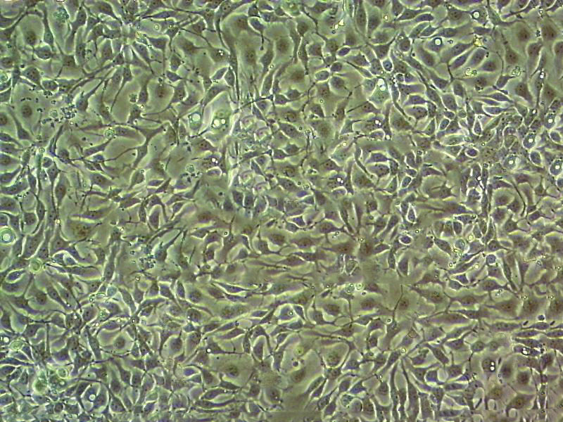 SF763 Epithelial Cell|人脑瘤传代细胞(有STR鉴定)