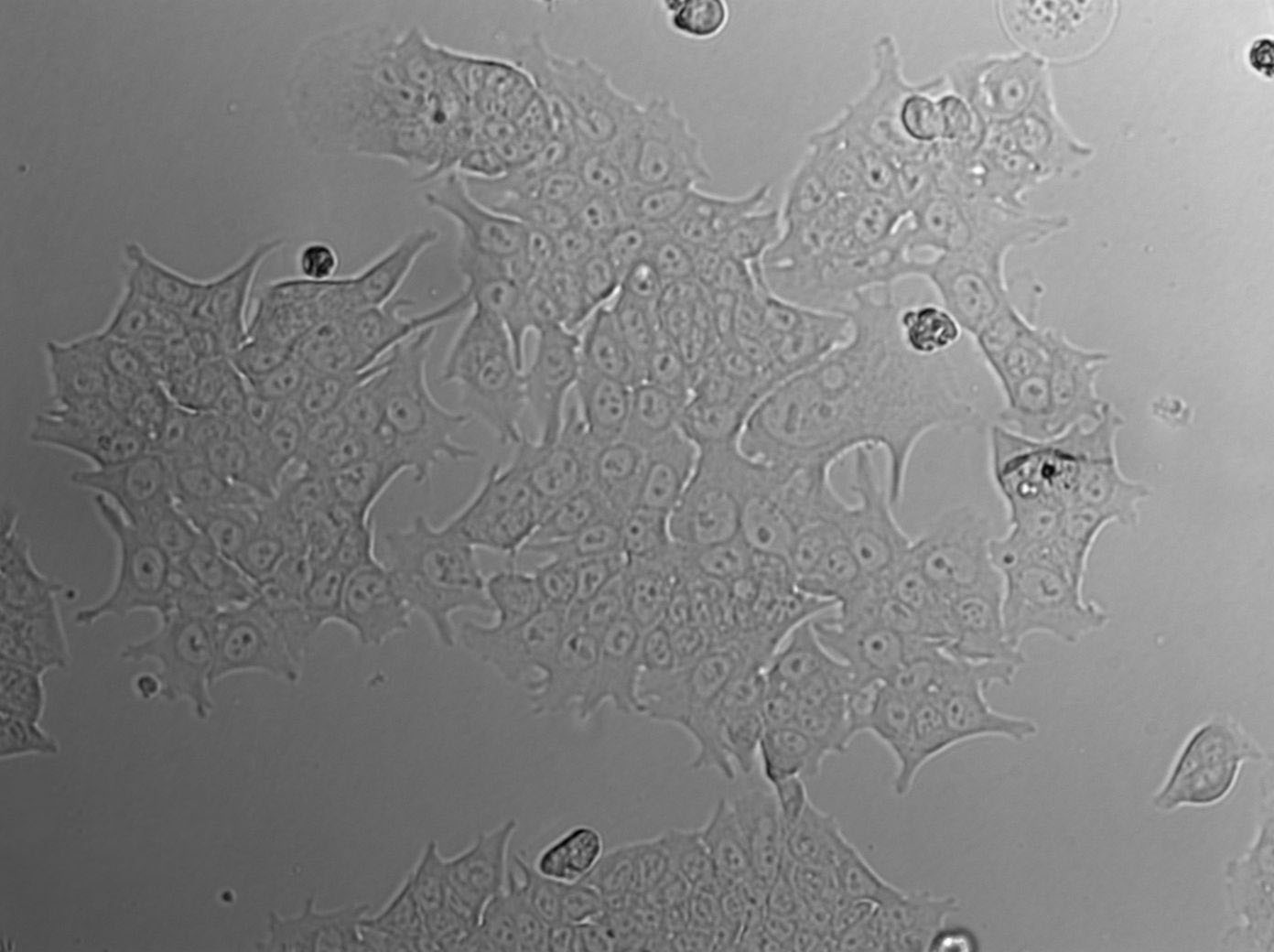 CAL-62 Epithelial Cell|人甲状腺癌传代细胞(有STR鉴定)