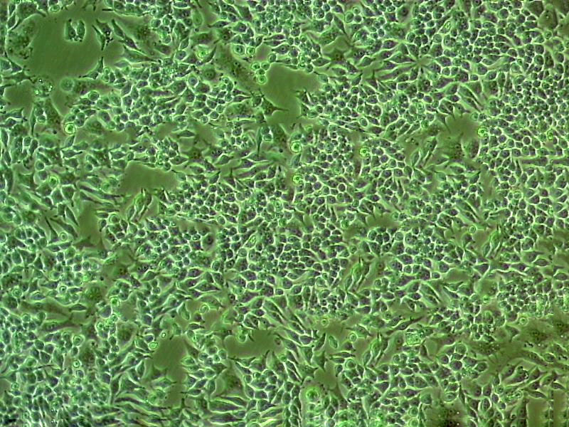 Chang liver Epithelial Cell|人张氏肝传代细胞(有STR鉴定)