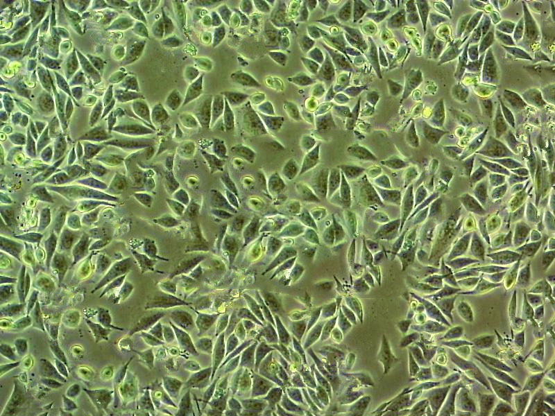 ECV-304 Epithelial Cell|人脐静脉内皮传代细胞(有STR鉴定)