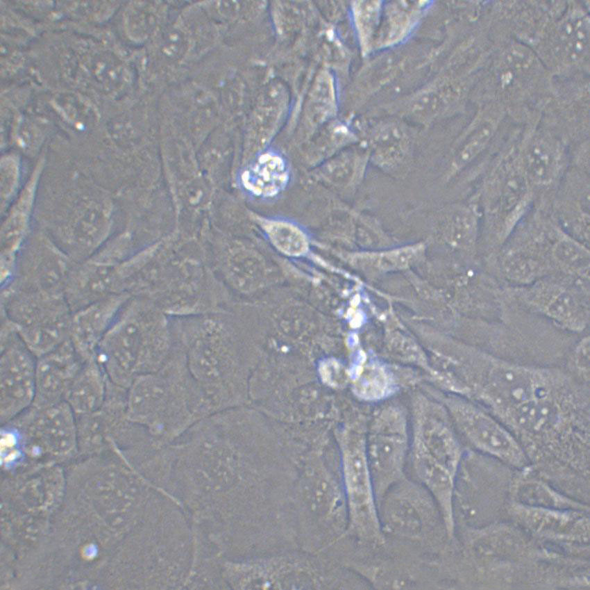CAL-85-1 Epithelial Cell|人乳腺癌传代细胞(有STR鉴定)
