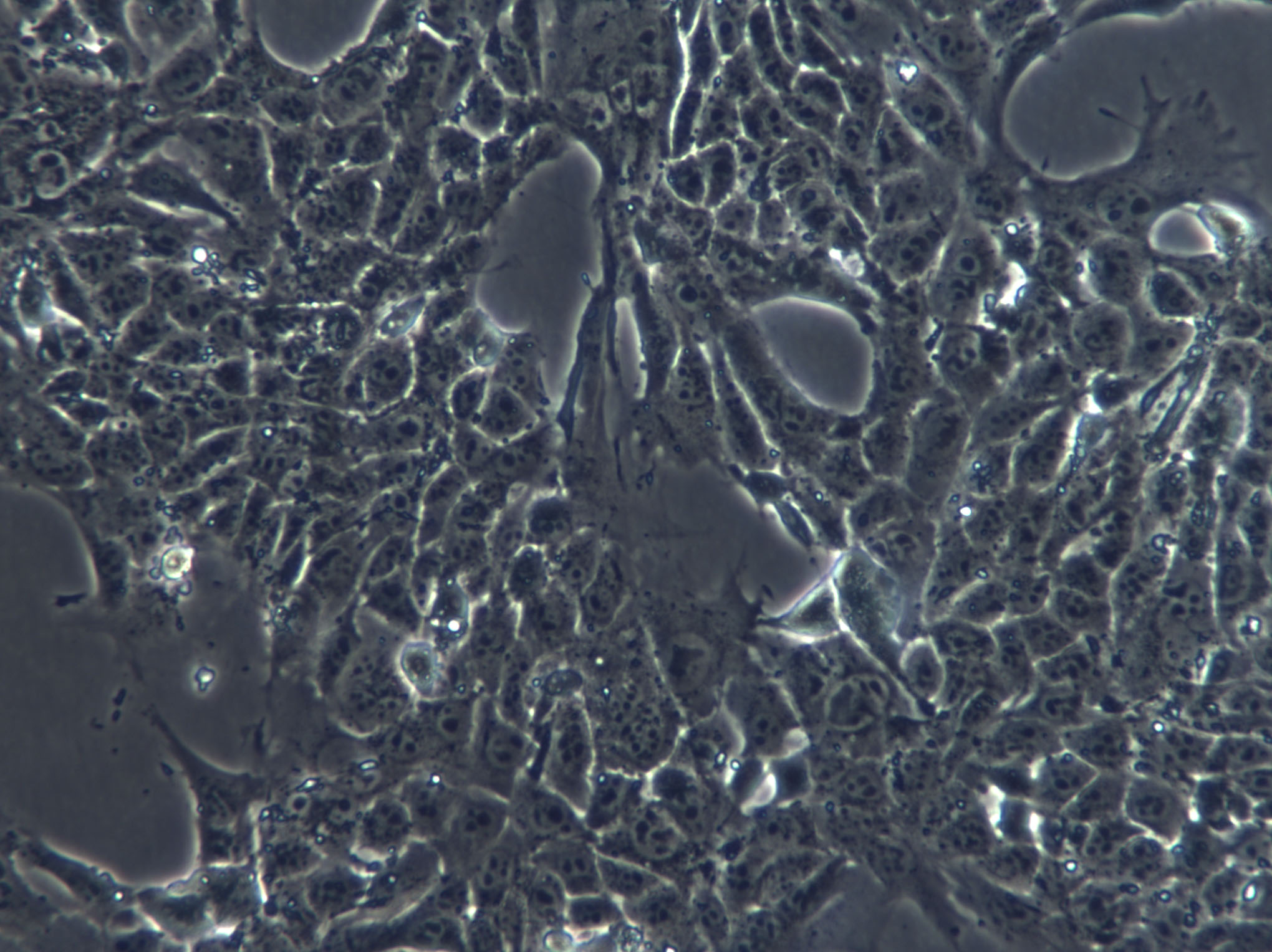 SNU-869 Epithelial Cell|人胆管癌传代细胞(有STR鉴定)