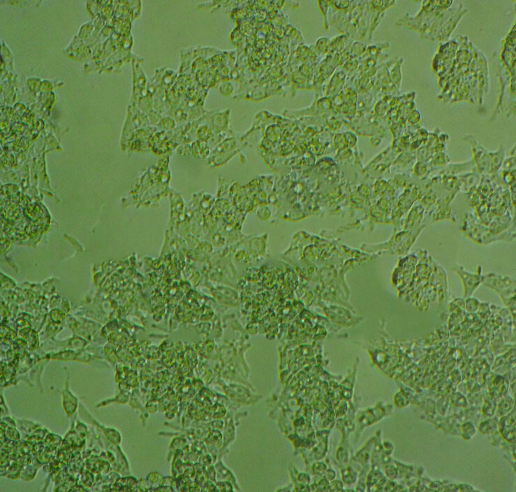 SW780 Epithelial Cell|人膀胱移行癌传代细胞(有STR鉴定)