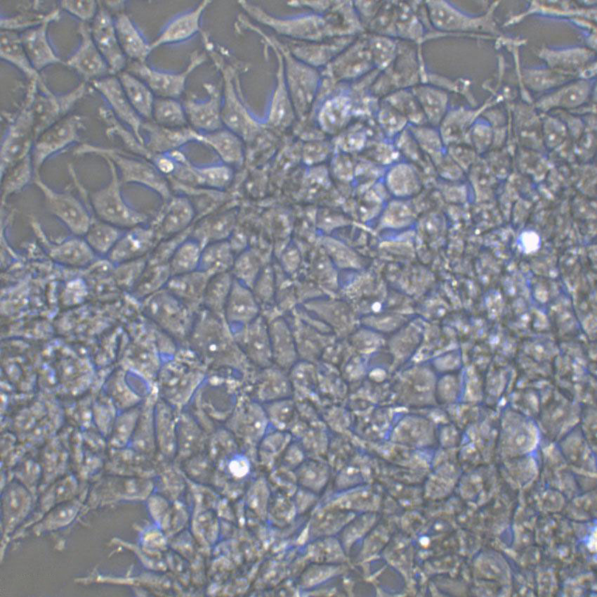 MDST8 Epithelial Cell|人结肠癌传代细胞(有STR鉴定)