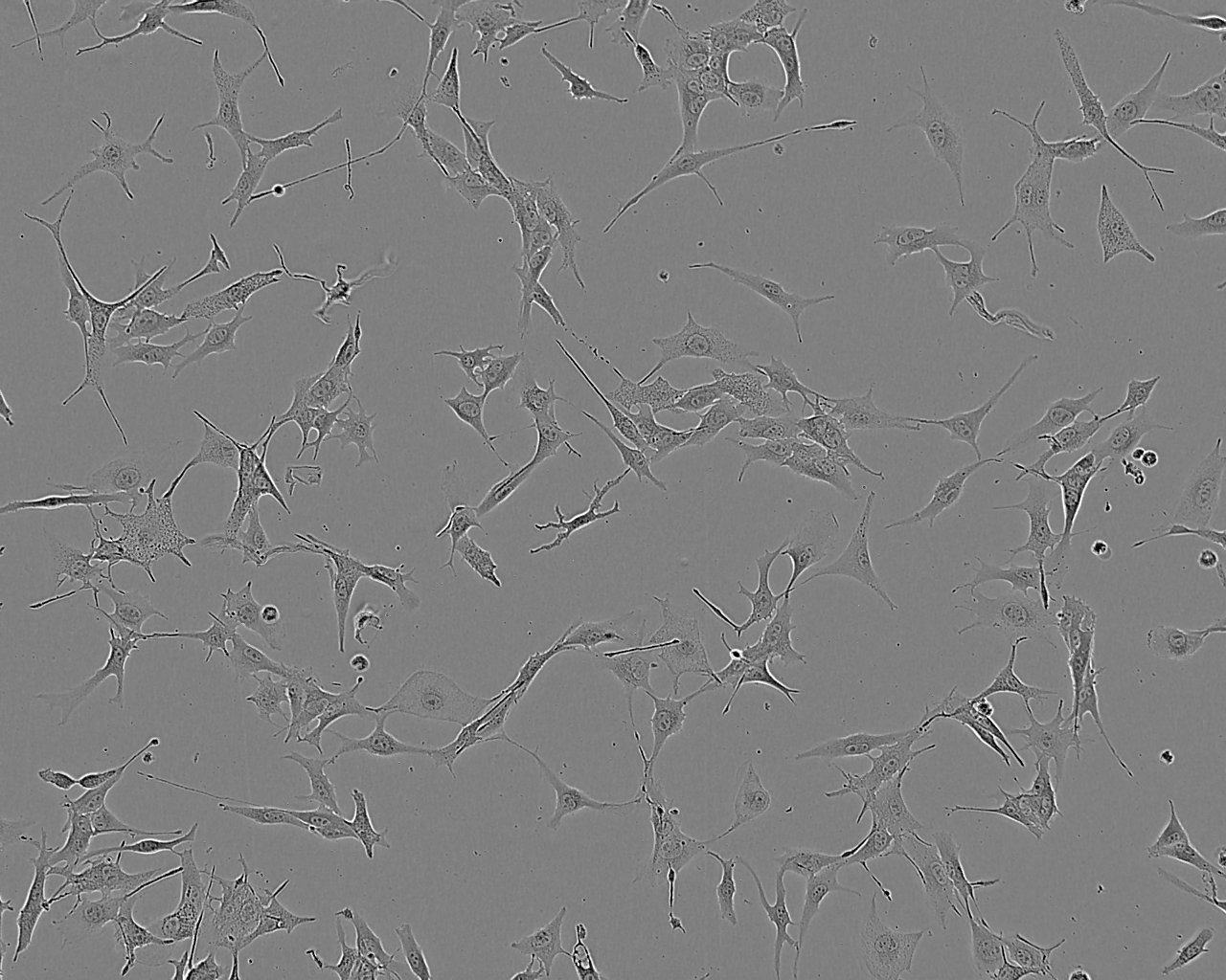 NCI-H1385 Epithelial Cell|人肺癌传代细胞(有STR鉴定)