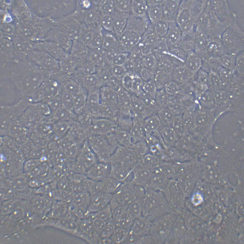 TE-12 Epithelial Cell|人食道癌肿瘤传代细胞(有STR鉴定)