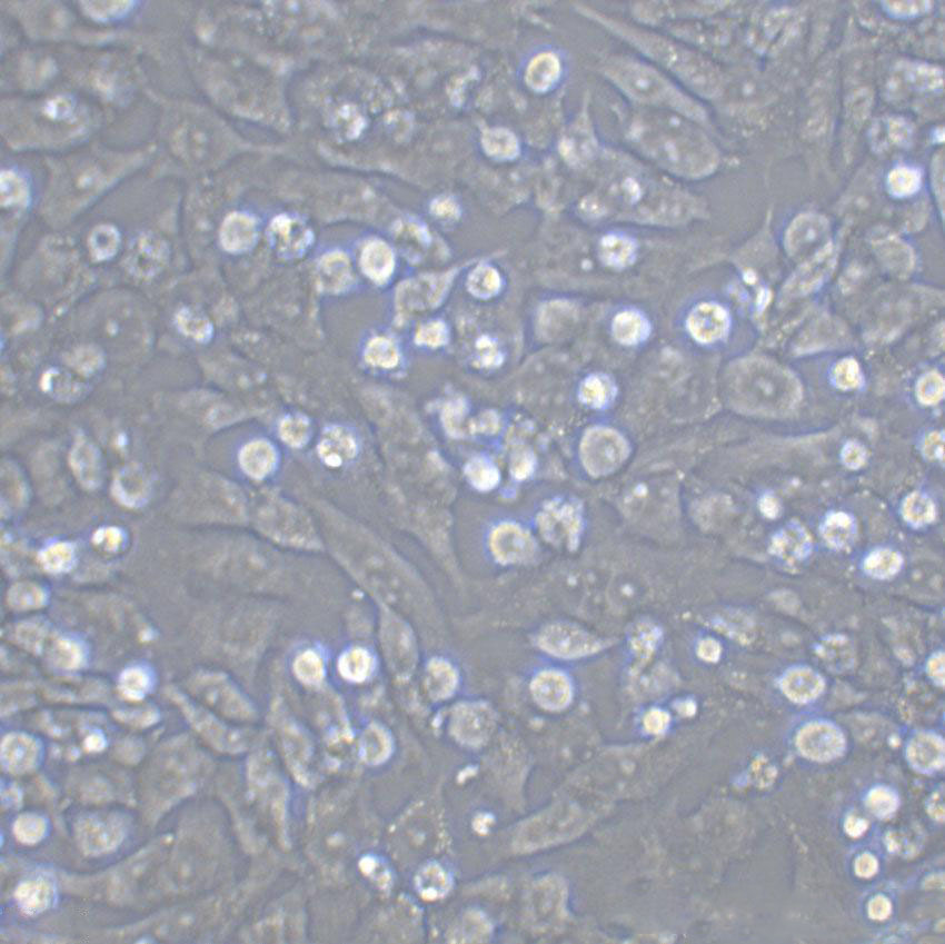 SW756 Epithelial Cell|人子宫鳞状癌传代细胞(有STR鉴定)