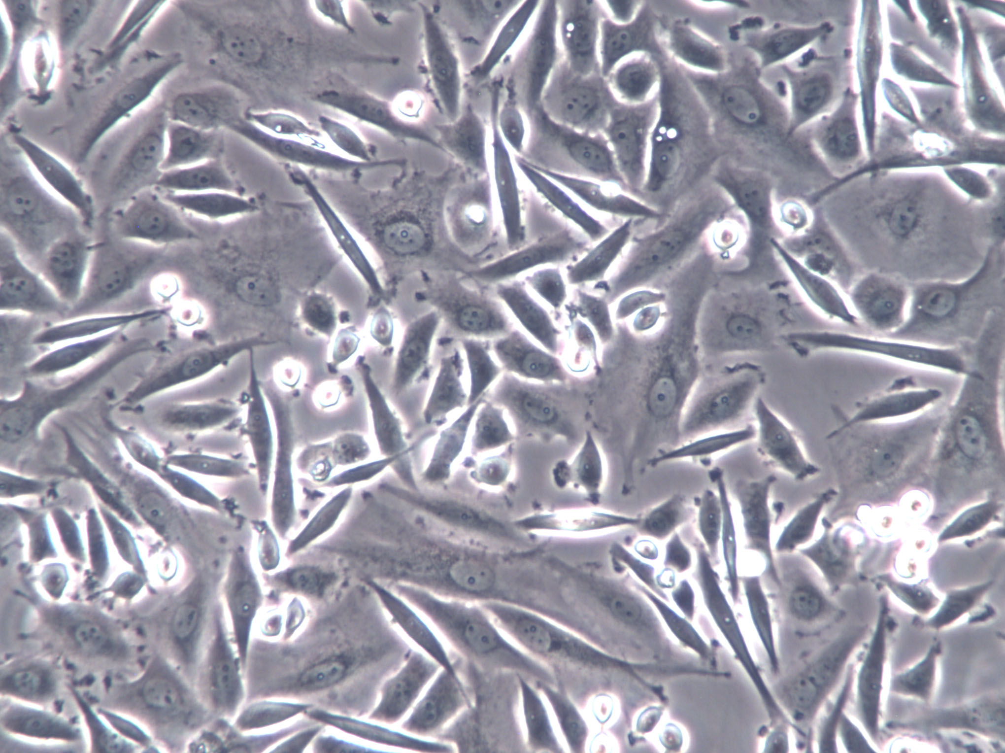 NUGC-2 Epithelial Cell|人低分化胃癌腺癌传代细胞(有STR鉴定)