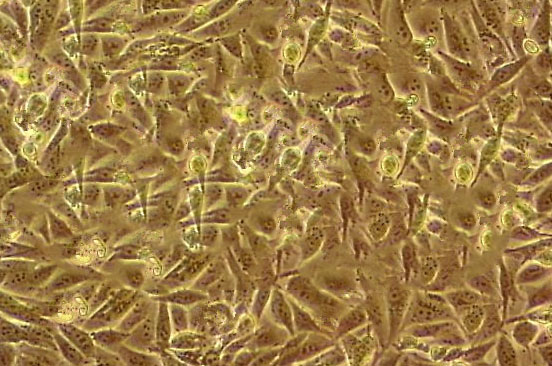 HCC95 Epithelial Cell|人肺鳞状细胞癌传代细胞(有STR鉴定)