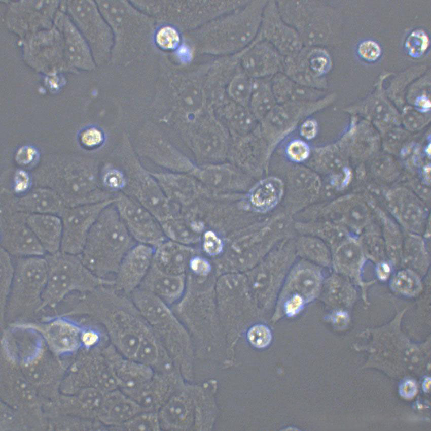 COLO 684 Epithelial Cell|人子宫腺癌传代细胞(有STR鉴定)