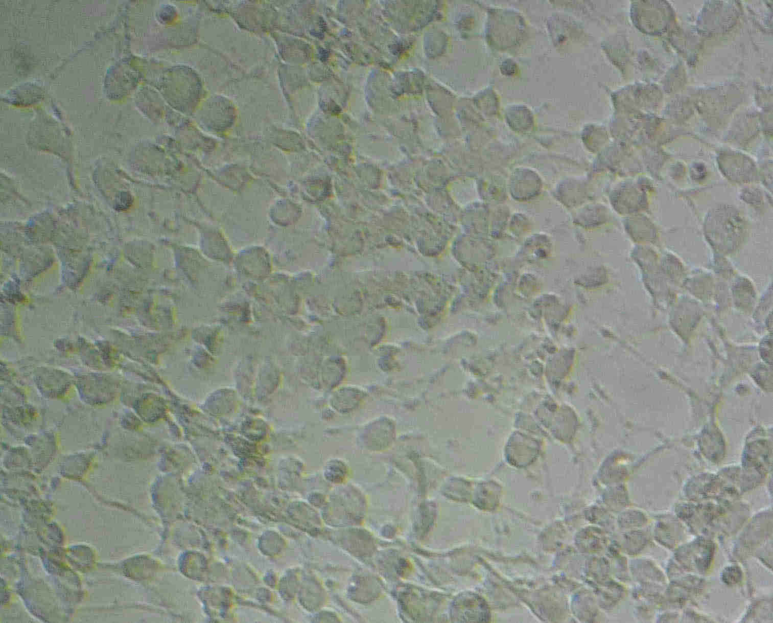 D407 Epithelial Cell|人视网膜色素上皮传代细胞(有STR鉴定)