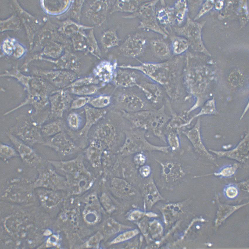 Tu 212 Epithelial Cell|人喉癌传代细胞(有STR鉴定)