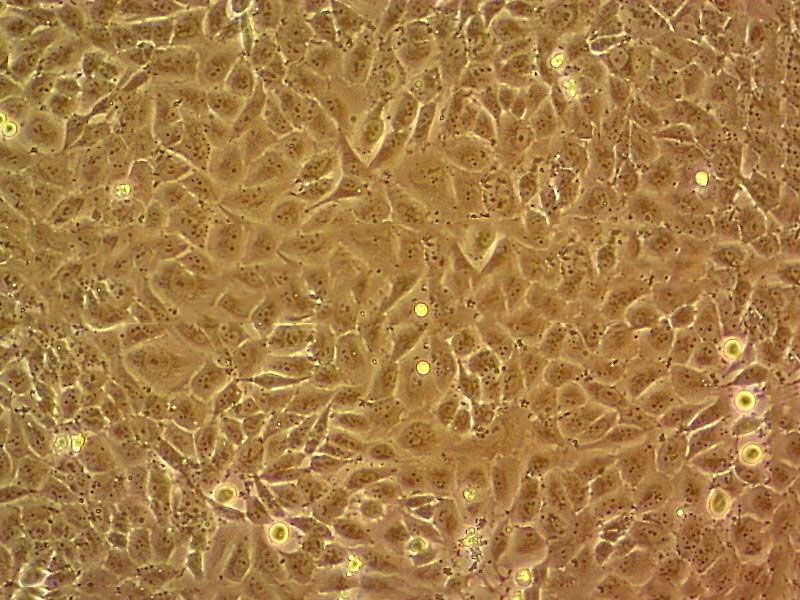 K1 Epithelial Cell|人甲状腺癌传代细胞(有STR鉴定)